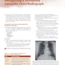 Learning Radiology: Recognizing the Basics