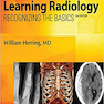 Learning Radiology: Recognizing the Basics
