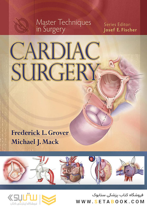 Cardiac Surgery (Master Techniques in Surgery)
