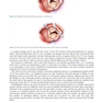 Cardiac Surgery (Master Techniques in Surgery)