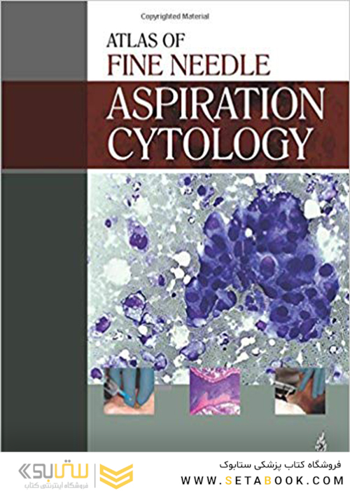 کتاب Atlas of Fine Needle Aspiration Cytology