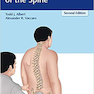 Physical Examination of the Spine 2nd Edicion