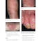 Skin Disease: Diagnosis and Treatment 4th Edition 2018