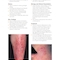 Skin Disease: Diagnosis and Treatment 4th Edition 2018