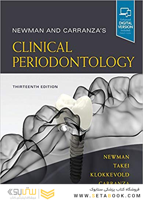 Newman and Carranza
