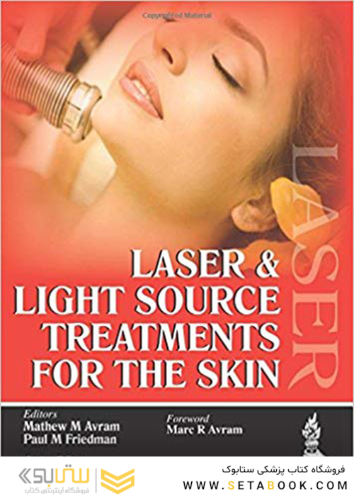 Lasers and Light Source Treatment for the Skin