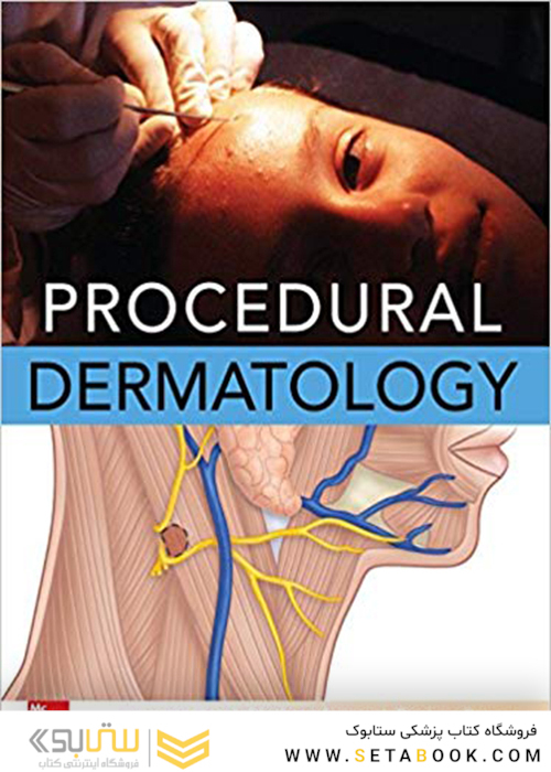 Procedural Dermatology
