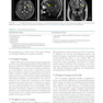 Nutrition and Lifestyle in Neurological Autoimmune Diseases : Multiple Sclerosis