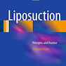 Liposuction : Principles and Practice