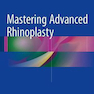 Mastering Advanced Rhinoplasty