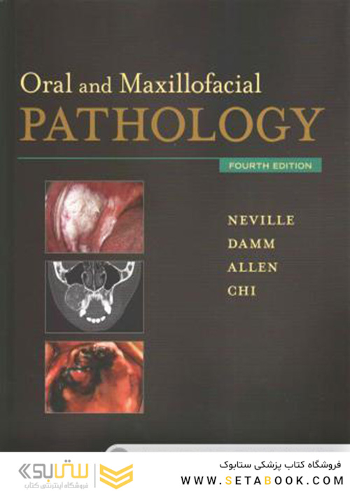 Oral and Maxillofacial Pathology