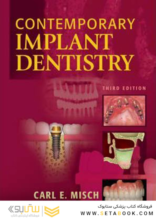 Contemporary Implant Dentistry