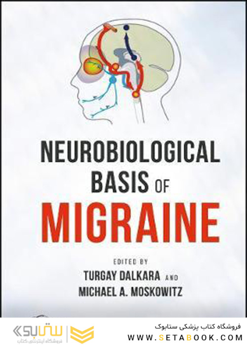Neurobiological Basis of Migraine