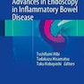 Advances in Endoscopy in Inflammatory Bowel Disease