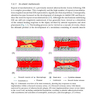 Functionalised Cardiovascular Stents