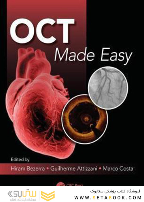 OCT Made Easy