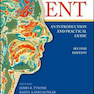 ENT: An Introduction and Practical Guide