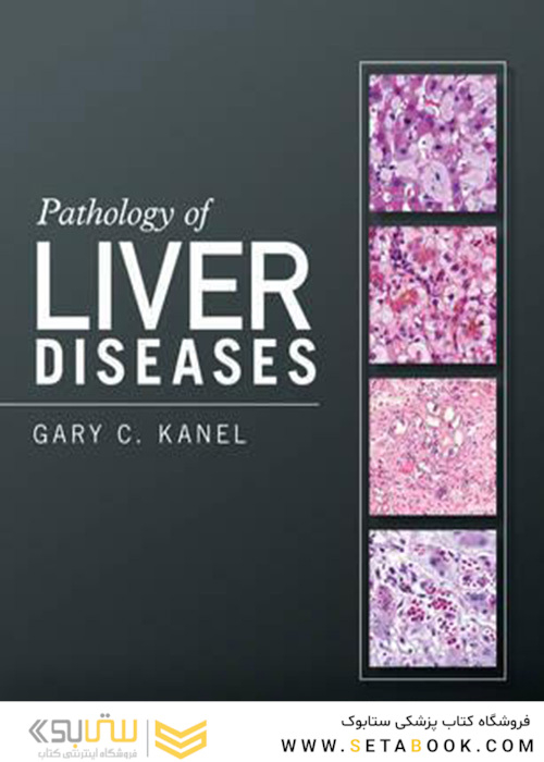 Pathology of Liver Diseases