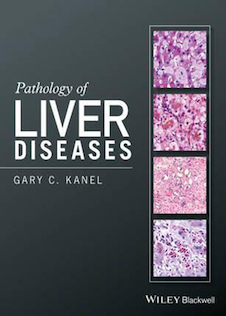 عکس Pathology of Liver Diseases