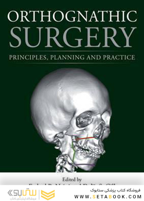 Orthognathic Surgery : Principles, Planning and Practice