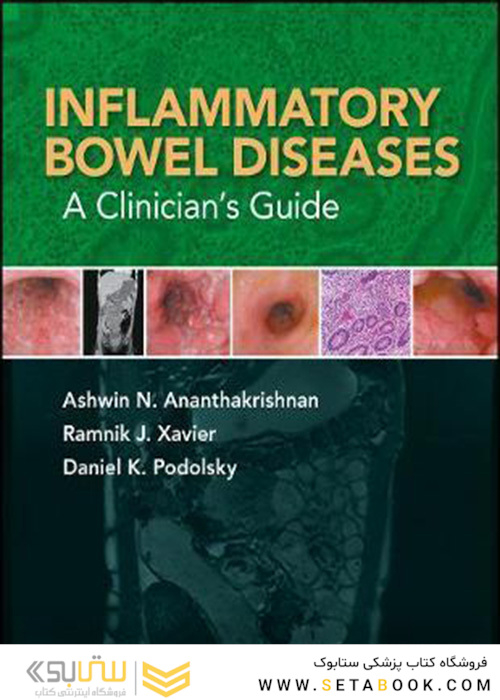 Inflammatory Bowel Diseases : A Clinician