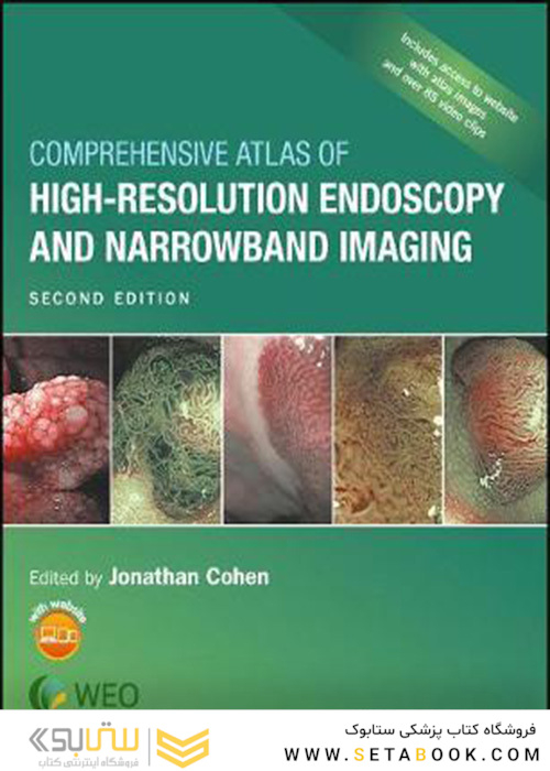 Comprehensive Atlas of High-Resolution Endoscopy and Narrowband Imaging