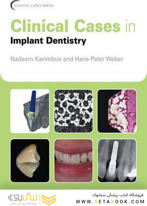 Clinical Cases in Implant Dentistry