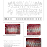 Clinical Cases in Implant Dentistry