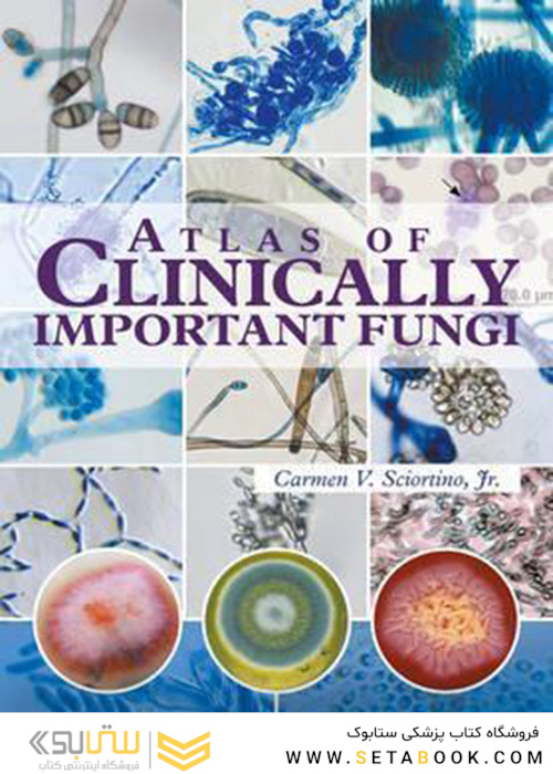 Atlas of Clinically Important Fungi2017