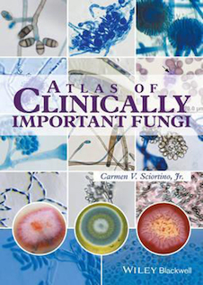 عکس Atlas of Clinically Important Fungi2017