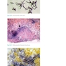 Atlas of Clinically Important Fungi2017