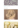 Atlas of Clinically Important Fungi2017
