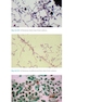 Atlas of Clinically Important Fungi2017