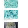 Atlas of Clinically Important Fungi2017