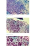 Atlas of Clinically Important Fungi2017