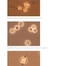 Atlas of Clinically Important Fungi2017