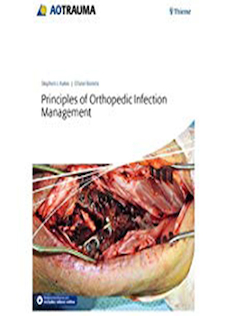 عکس Principles of Orthopedic Infection Management