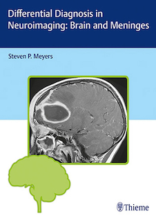 عکس Differential Diagnosis in Neuroimaging: Brain and Meninges
