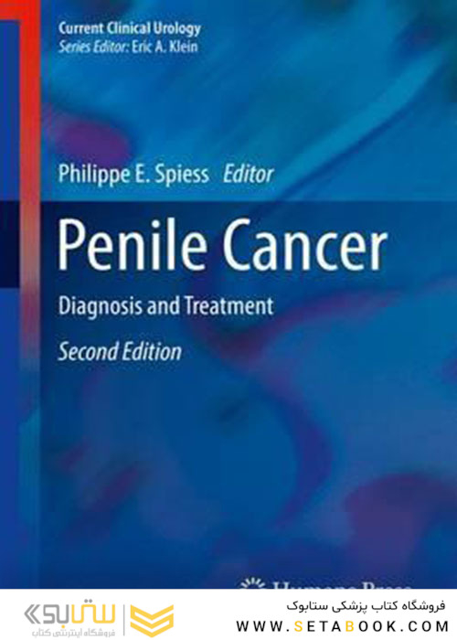 Penile Cancer : Diagnosis and Treatment