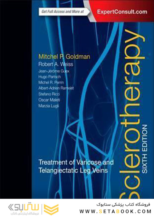 Sclerotherapy : Treatment of Varicose and Telangiectatic Leg Veins