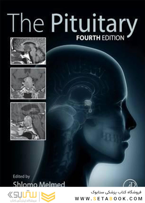 The Pituitary