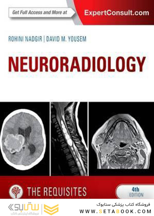 Neuroradiology: The Requisites