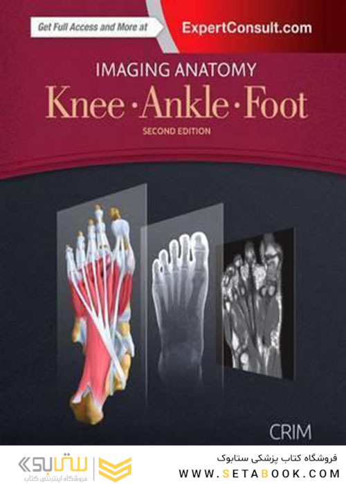 Imaging Anatomy: Knee, Ankle, Foot
