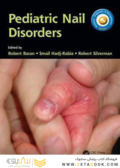 Pediatric Nail Disorders