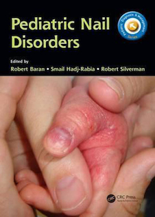 عکس Pediatric Nail Disorders