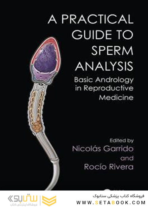Practical Guide to Sperm Analysis : Basic Andrology in Reproductive Medicine