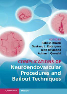 عکس Complications of Neuroendovascular Procedures and Bailout Techniques