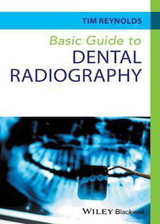 عکس Basic Guide to Dental Radiography