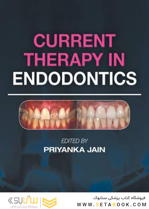 Current Therapy in Endodontics