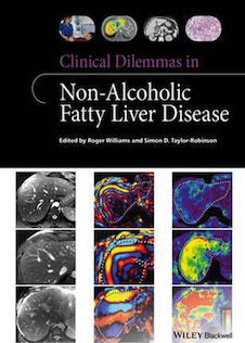 عکس Clinical Dilemmas in Non-Alcoholic Fatty Liver Disease